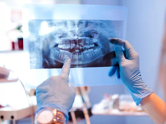 zdjęcie rentgenowskie zębów